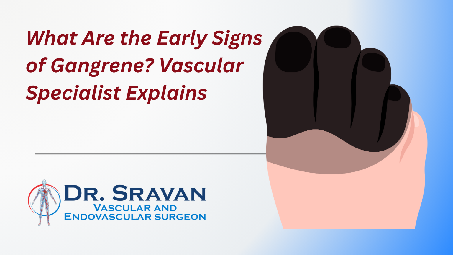 What Are the Early Signs of Gangrene? Vascular Specialist Explains