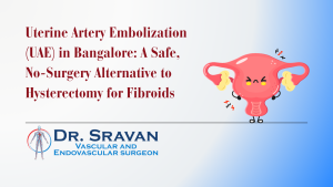 Uterine Artery Embolization (UAE) in Bangalore: A Safe, No-Surgery Alternative to Hysterectomy for Fibroids