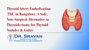 Thyroid Artery Embolization (TAE) in Bangalore: A Safe, Non-Surgical Alternative to Thyroidectomy for Thyroid Nodules & Goitre