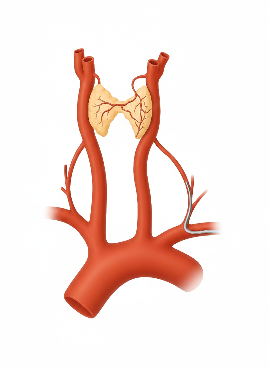 Illustration showing thyroid arteries supplying blood to the thyroid gland