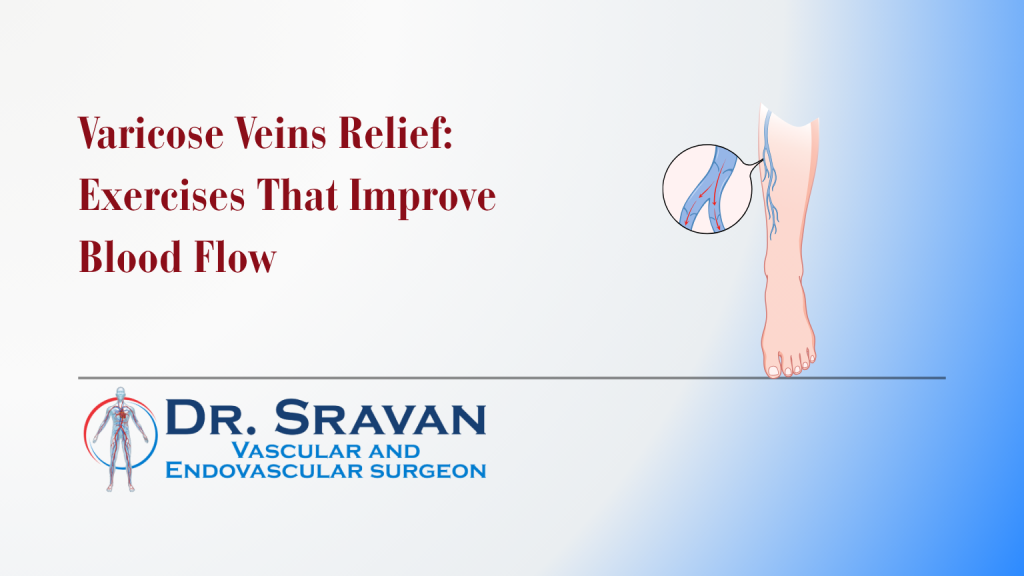 Varicose veins relief - exercises that improve blood flow