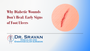 Why Diabetic Wounds Don’t Heal: Early Signs of Foot Ulcers