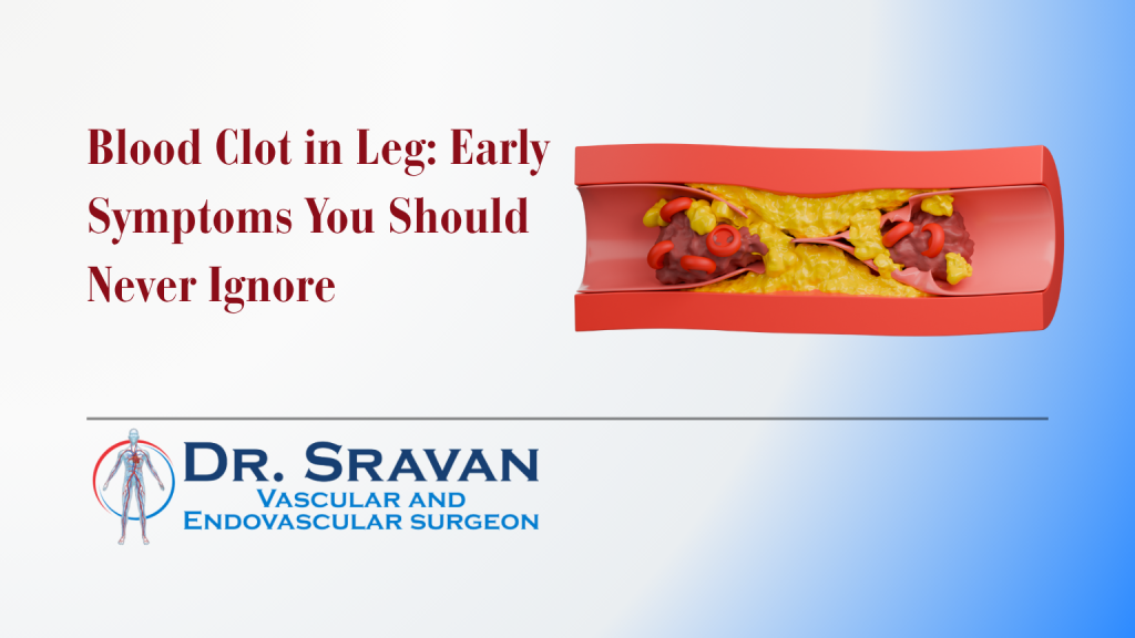 blood clots in leg