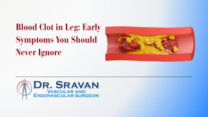 blood clots in leg