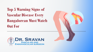 Top 5 Warning Signs of Vascular Disease Every Bangalorean Must Watch Out For