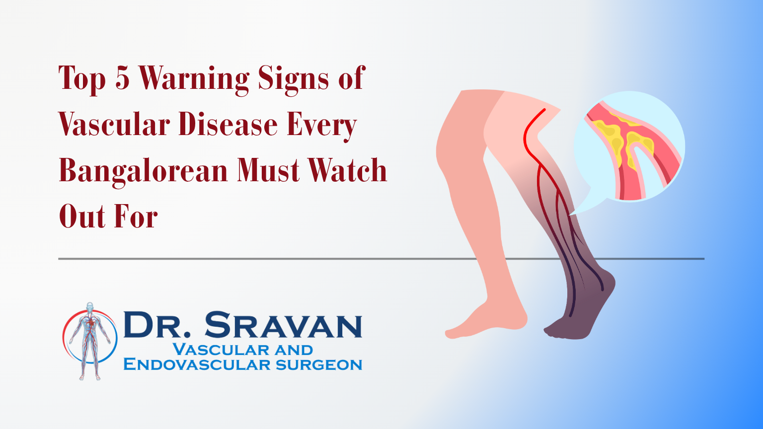 Top 5 Warning Signs of Vascular Disease Every Bangalorean Must Watch Out For