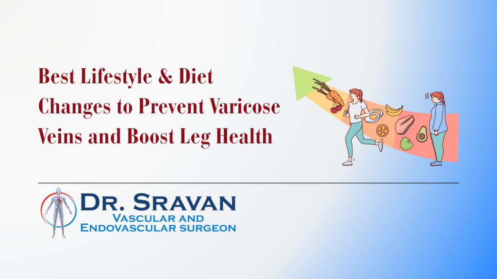 Best Lifestyle & Diet Changes to Prevent Varicose Veins and Boost Leg Health