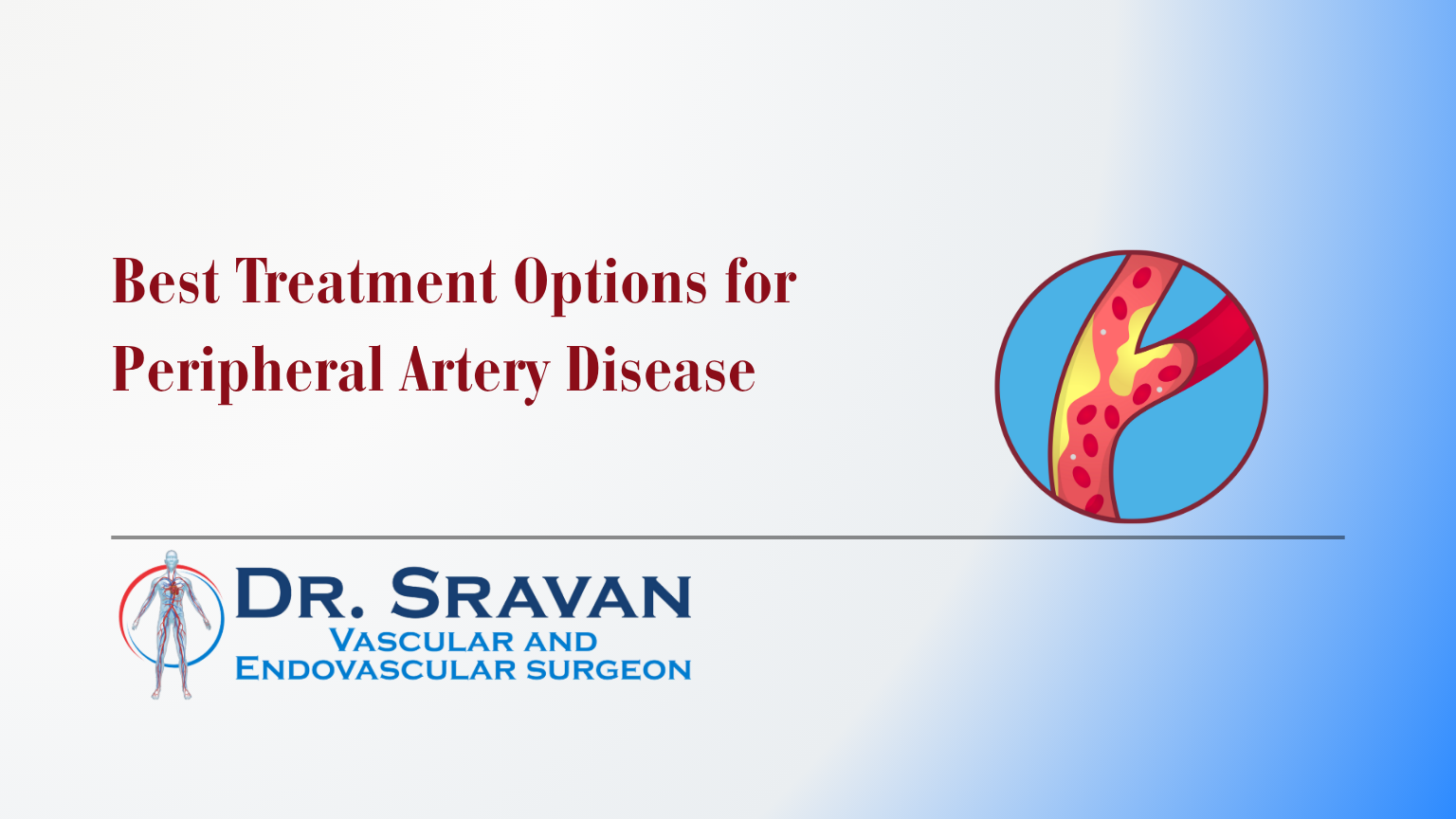 Best Treatment Options for Peripheral Artery Disease – Insights from one of Bangalore’s leading Vascular Surgeons, Dr. Sravan C.P.S, Basavanagudi