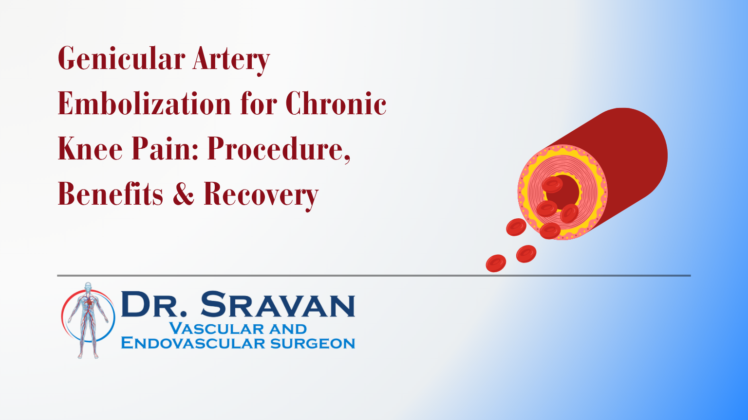 Genicular Artery Embolization for Chronic Knee Pain: Procedure, Benefits & Recovery – Insights from one of Bangalore’s leading Vascular Surgeons, Dr. Sravan C.P.S, Basavanagudi
