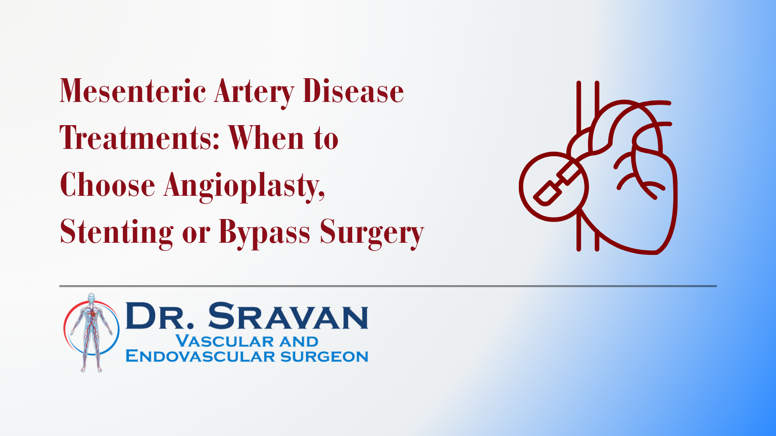 Mesenteric Artery Disease Treatments: When to Choose Angioplasty, Stenting or Bypass Surgery