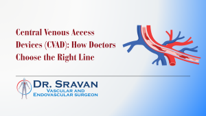 Central Venous Access Devices (CVAD): How Doctors Choose the Right Line