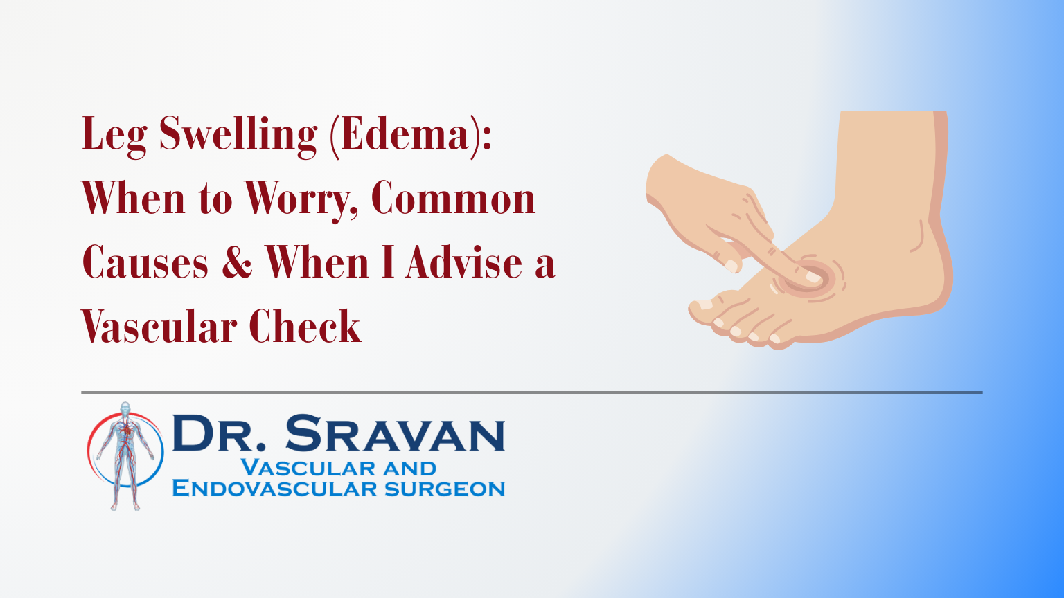 Leg Swelling (Edema): When to Worry, Common Causes & When I Advise a Vascular Check