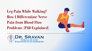 Leg Pain While Walking? How I Differentiate Nerve Pain from Blood Flow Problems (PAD Explained)