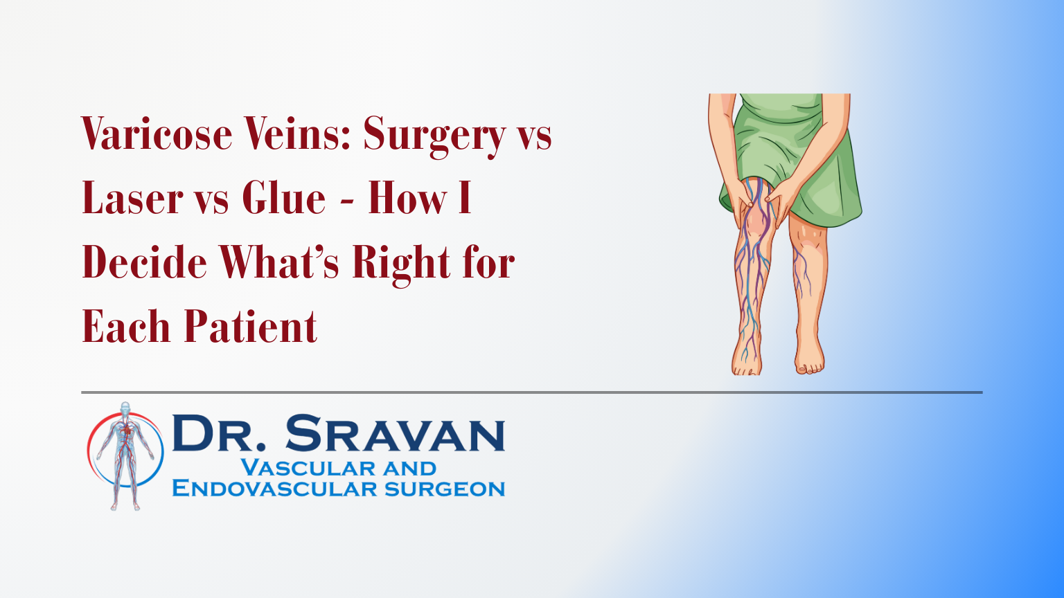Varicose Veins: Surgery vs Laser vs Glue - How I Decide What’s Right for Each Patient