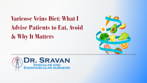 Varicose Veins Diet: What I Advise Patients to Eat, Avoid & Why It Matters
