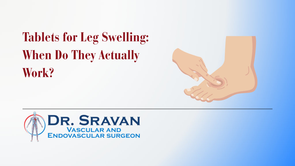 Tablets for Leg Swelling: When Do They Actually Work?