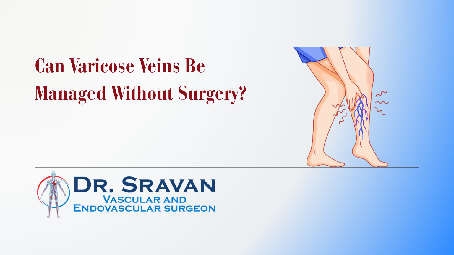 Can Varicose Veins Be Managed Without Surgery?