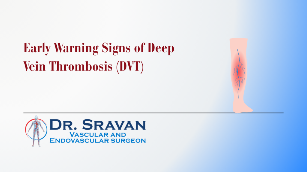 Early Warning Signs of Deep Vein Thrombosis (DVT)