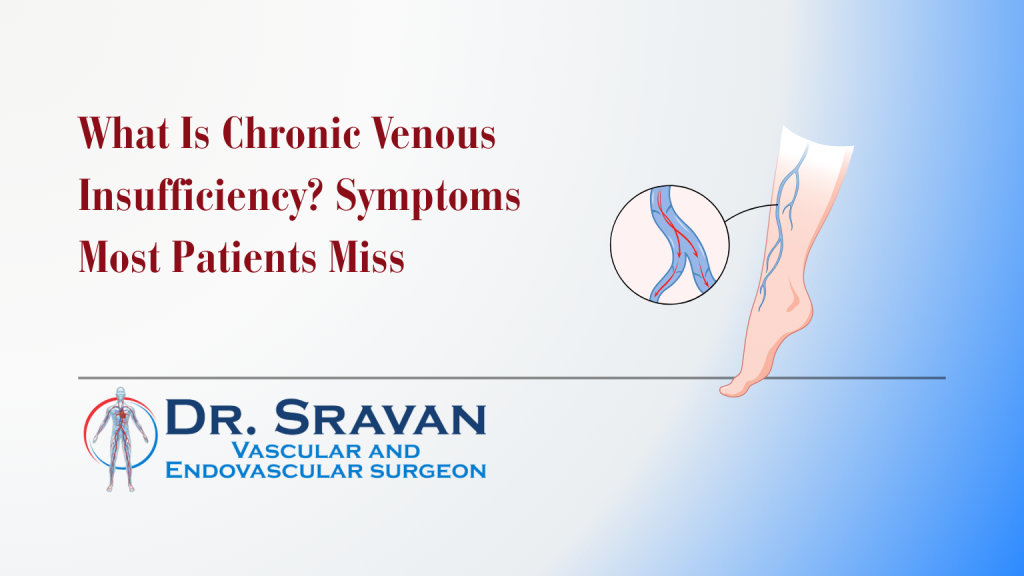 Chronic Venous Insufficiency (CVI): Symptoms to Know