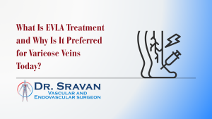 What Is EVLA Treatment and Why Is It Preferred for Varicose Veins Today?