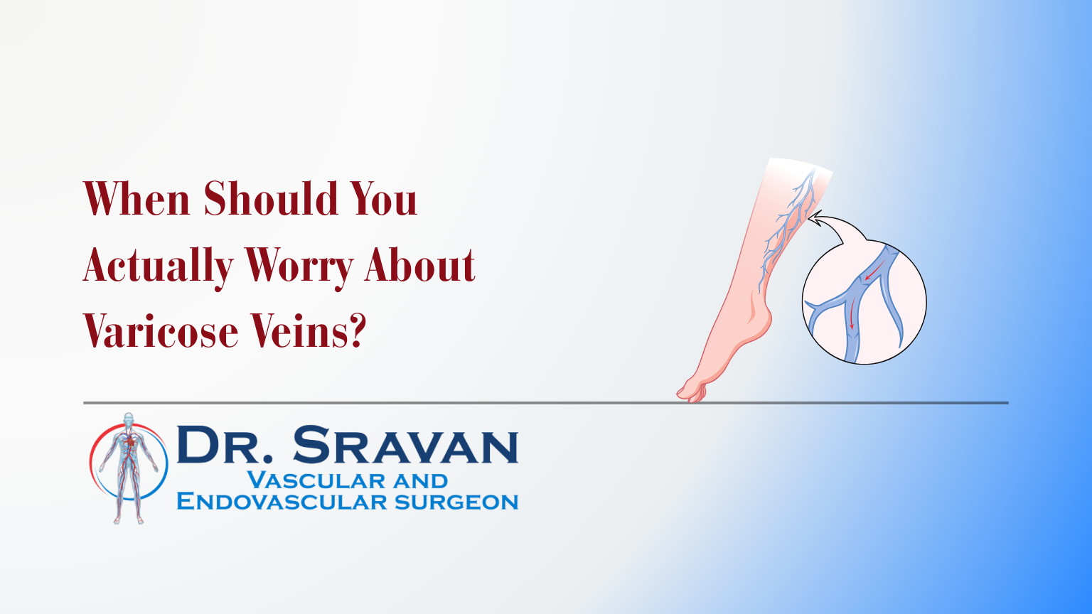 When Should You Actually Worry About Varicose Veins?