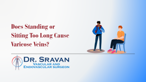 Does Standing or Sitting Too Long Cause Varicose Veins?