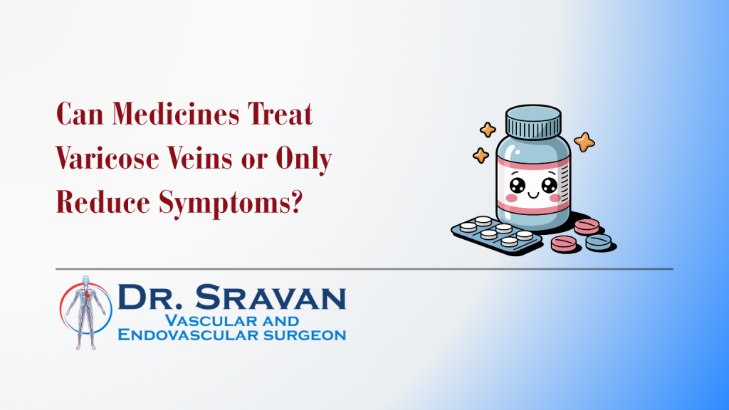 varicose veins medicine or treatment? what works
