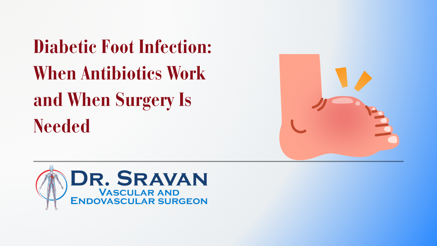 Diabetic Foot Infection: Antibiotics vs Surgery Guide