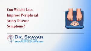 Can Weight Loss Improve Peripheral Artery Disease Symptoms?