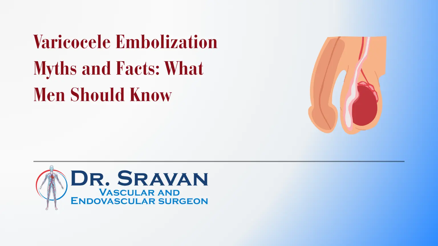 Varicocele Embolization Myths and Facts: What Men Should Know