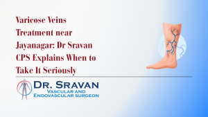 Varicose Veins Treatment near Jayanagar: Dr Sravan CPS Explains When to Take It Seriously