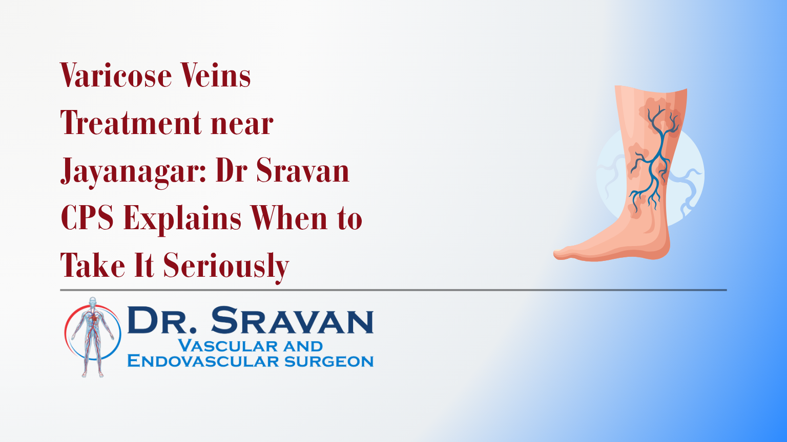 Varicose Veins Treatment near Jayanagar: Dr Sravan CPS Explains When to Take It Seriously