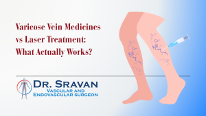 Varicose Vein Medicines vs Laser Treatment: What Actually Works?