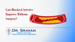 Can Blocked Arteries Improve Without Surgery?