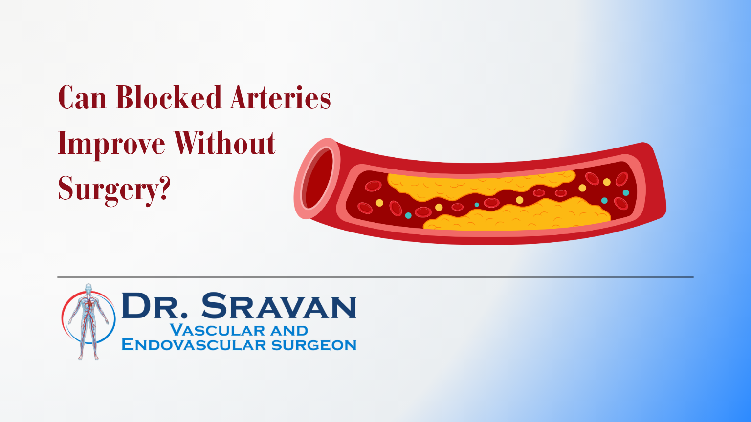 Can Blocked Arteries Improve Without Surgery?