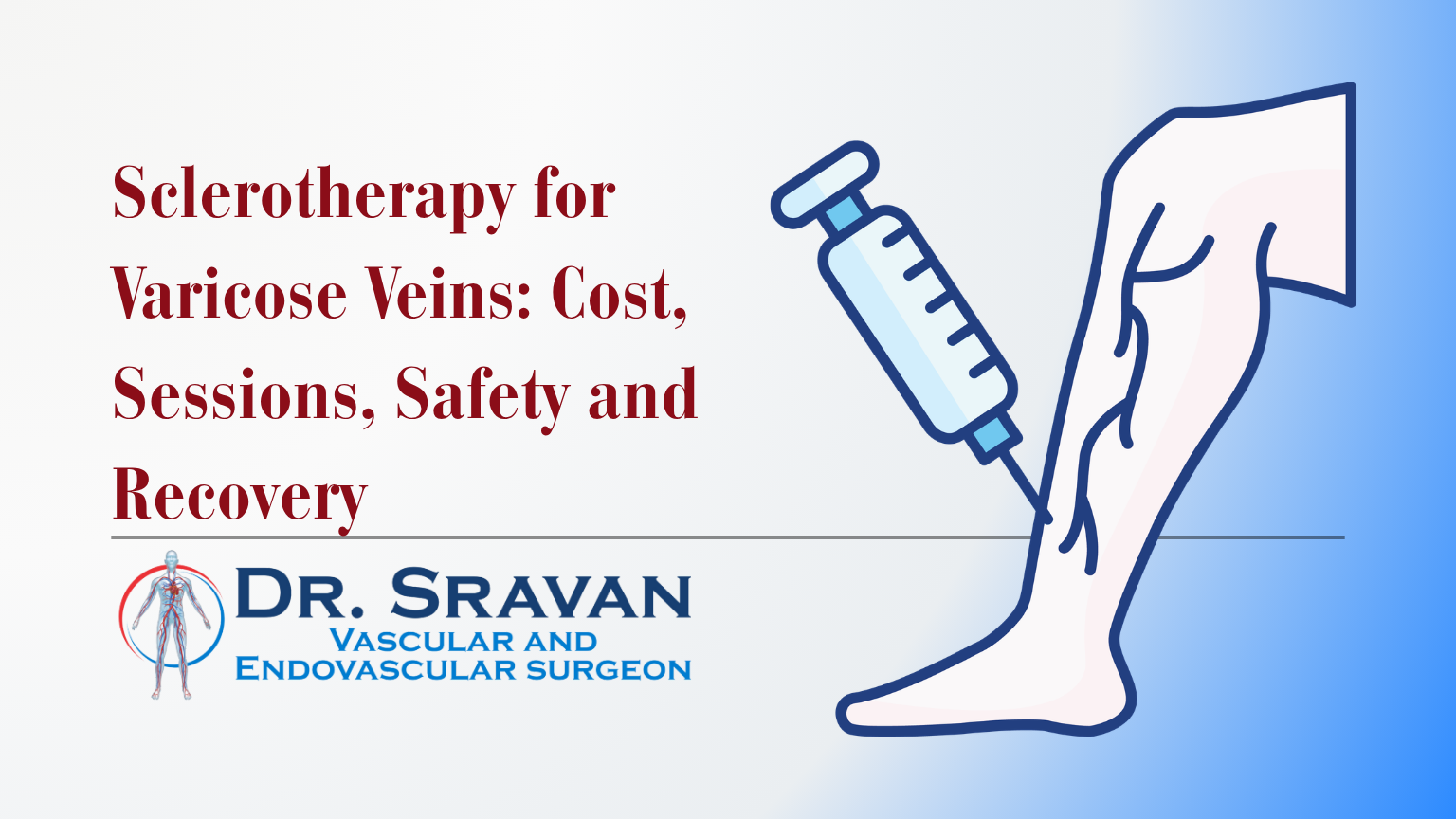 Sclerotherapy for Varicose Veins: Cost, Sessions, Safety and Recovery