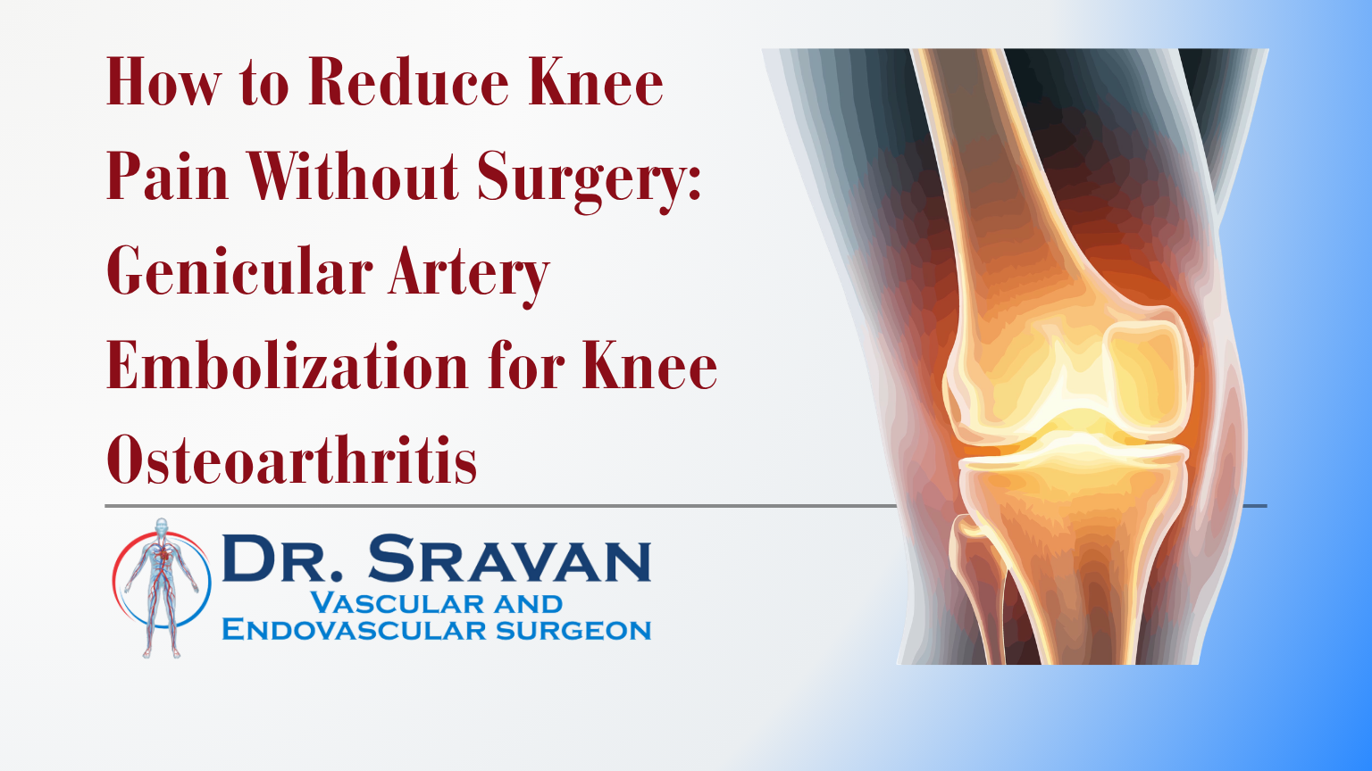 How to Reduce Knee Pain Without Surgery | Genicular Artery Embolisation