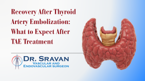 Recovery After Thyroid Artery Embolization: What to Expect After TAE Treatment