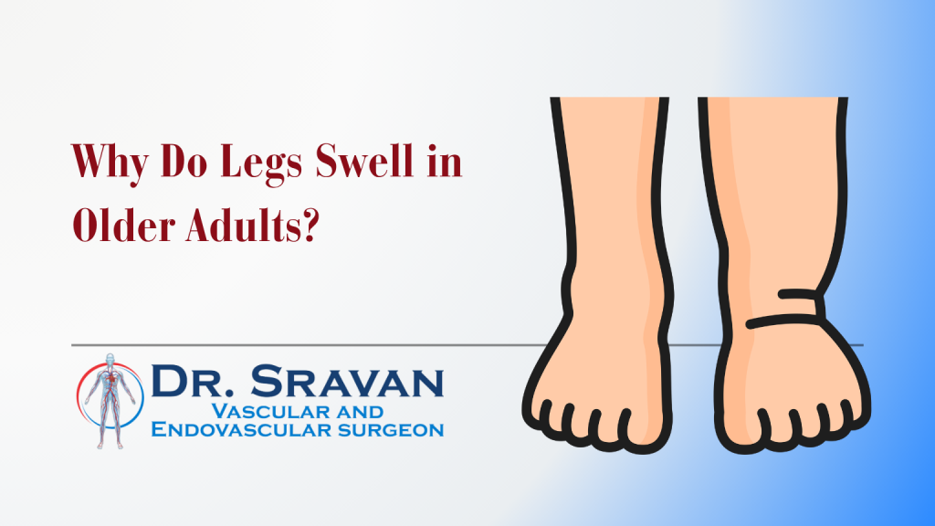 Why Do Legs Swell in Older Adults?
