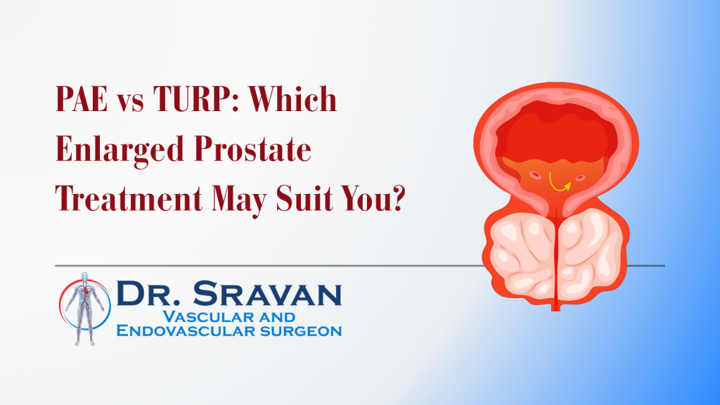 PAE vs TURP: Which Enlarged Prostate Treatment May Suit You?