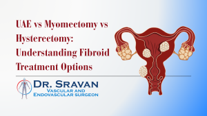 UAE vs Myomectomy vs Hysterectomy: Understanding Fibroid Treatment Options