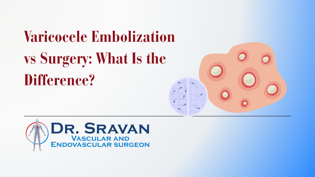 Varicocele Embolization vs Surgery: What Is the Difference?