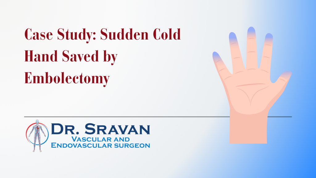 Case Study: Sudden Cold, Pulseless Hand from Acute Limb Ischemia