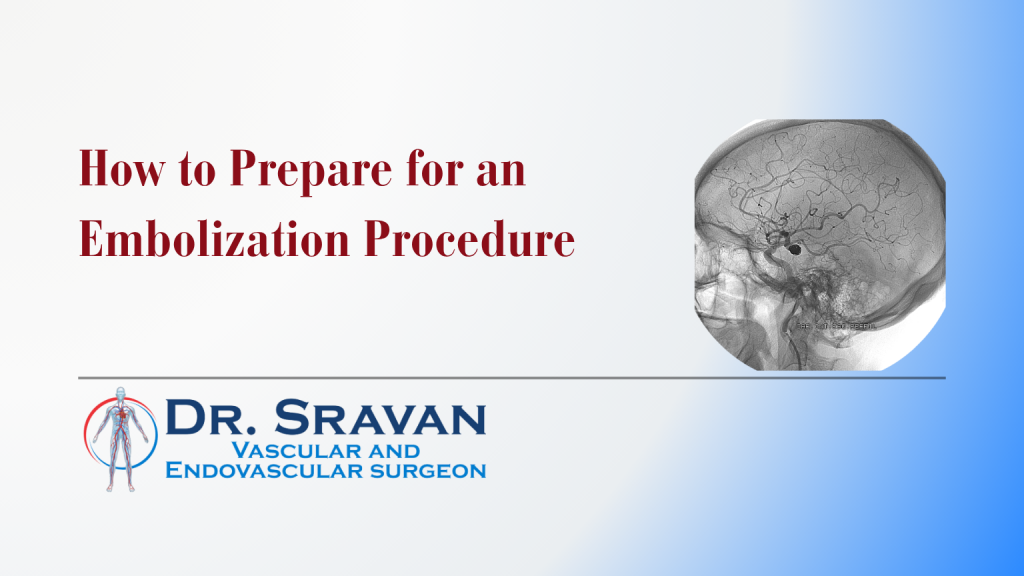 Learn how to prepare for an embolization procedure, including tests, fasting, medicines, allergies, diabetes care and what to bring to hospital.