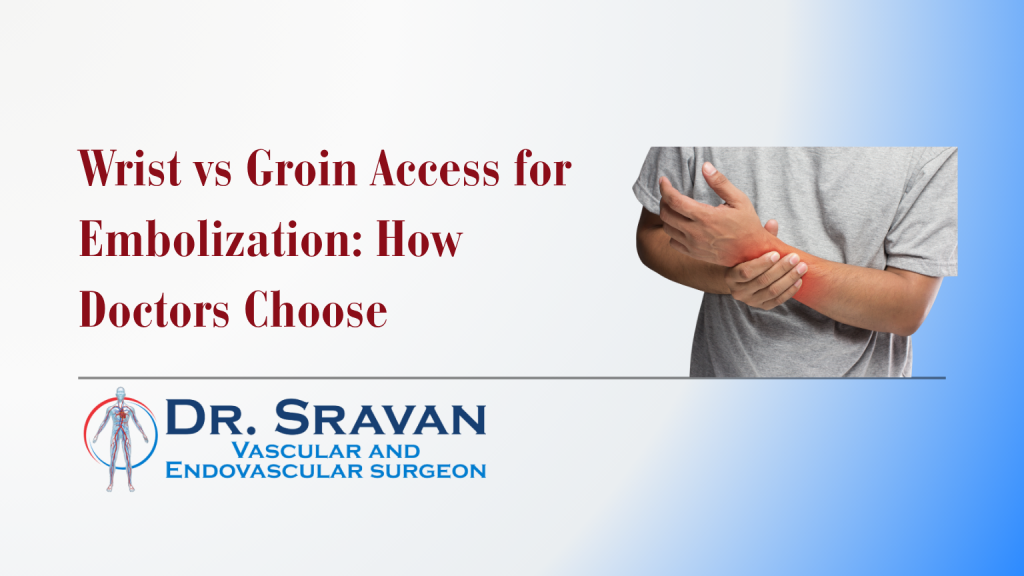 Wrist vs Groin Access for Embolization: How Doctors Choose