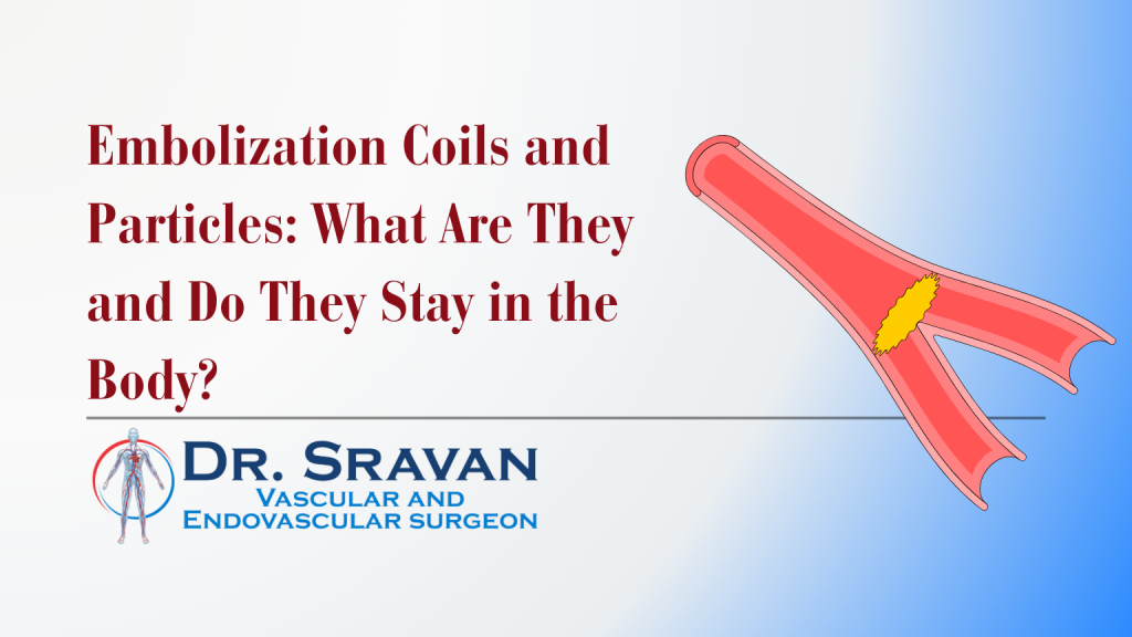 Embolization Coils and Particles: What Are They and Do They Stay in the Body?