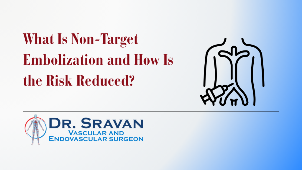 What Is Non-Target Embolization and How Is the Risk Reduced? | What Is Non-Target Embolization and How Is the Risk Reduced?