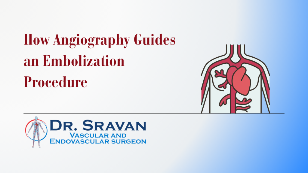 How Angiography Guides an Embolization Procedure