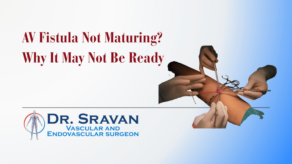 AV Fistula Not Maturing? Why It May Not Be Ready