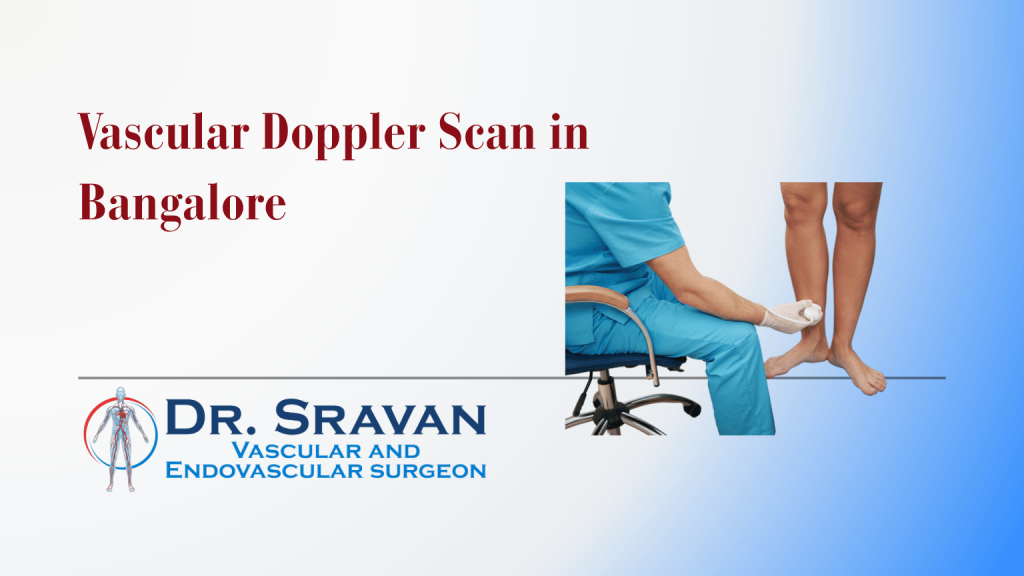 Vascular Doppler Scan in Bangalore